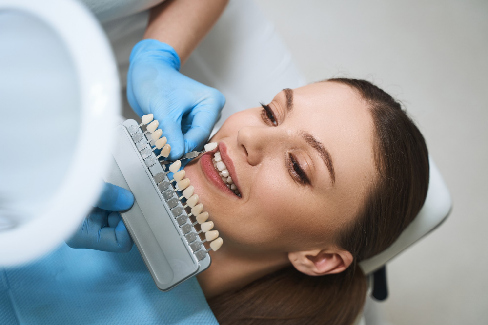 What Are Dental Veneers: A Detailed Guide