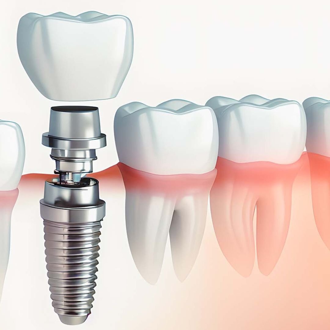 Dental Clinic In Hamilton Hill