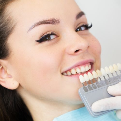 Cosmetic Dentistry: Enhance Your Smile with Veneers & Crowns