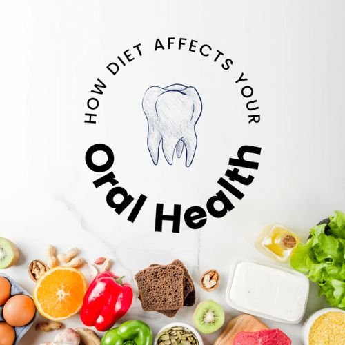 How Diet Affects Your Oral Health: What to Eat & Avoid